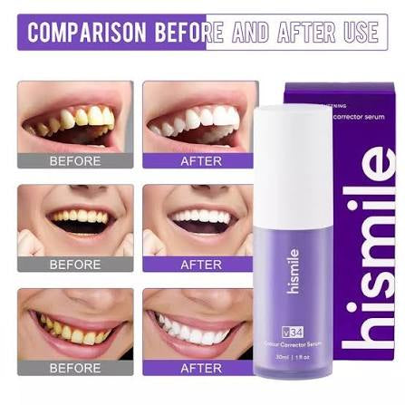 Hismile v34 Colour Corrector, Tooth Stain Removal, Teeth Whitening Booster