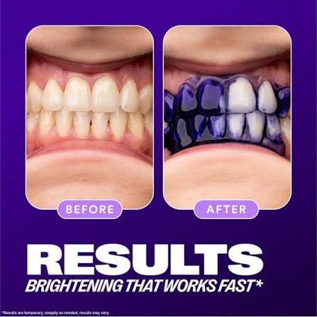 Hismile v34 Colour Corrector, Tooth Stain Removal, Teeth Whitening Booster
