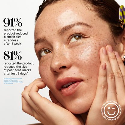 EradiKate Acne Mark Fading Gel