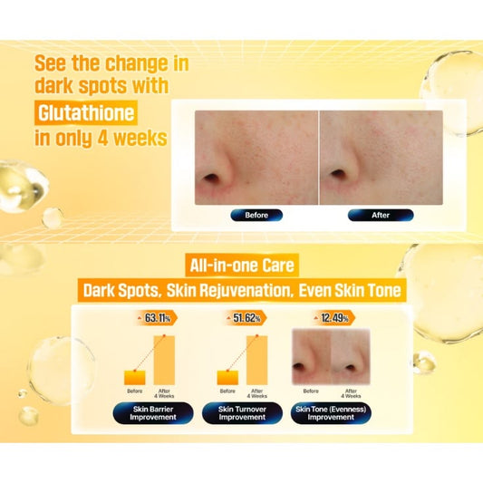 NUMBUZIN_No.5+ Glutathione Vitamin Dark Spot Cream