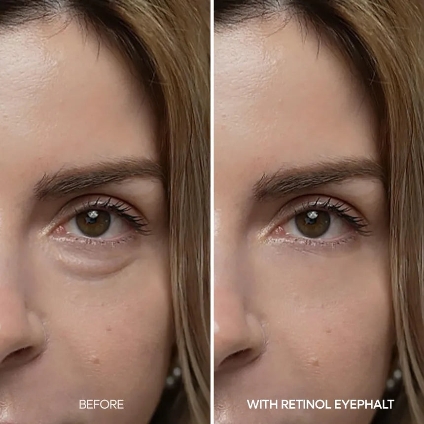 Dr. Melaxin Eyephalt Retinol Eyebag Cream 10g