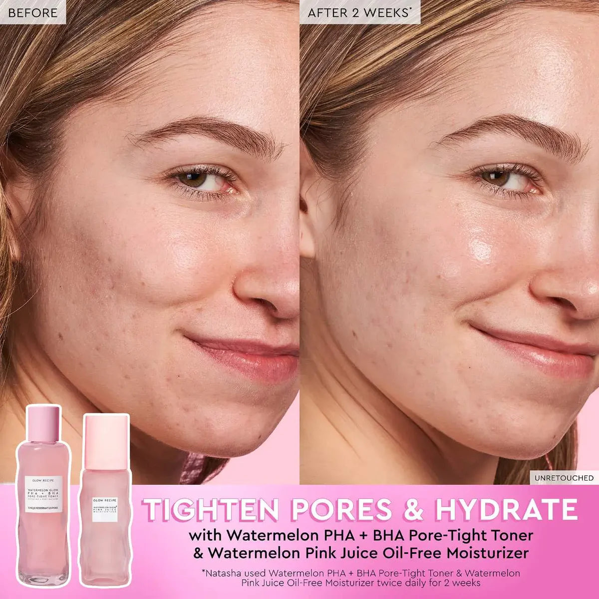 Glow Recipe Watermelon Glow PHA+ BHA Pore-Tight Toner