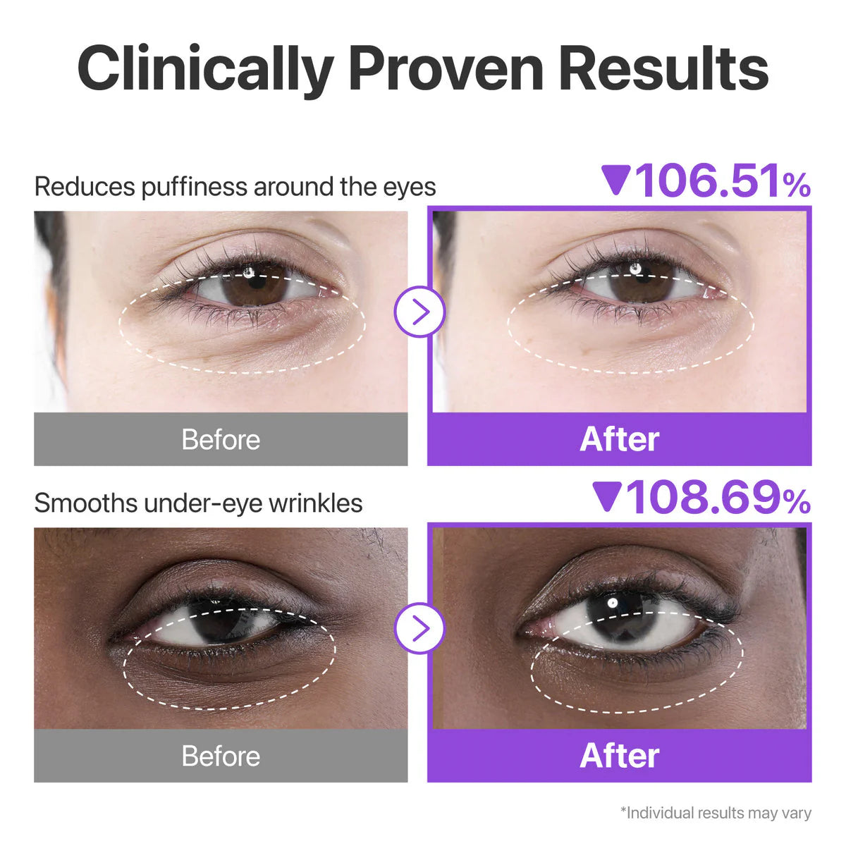 Numbuzin NAD+ collagen under eye patches